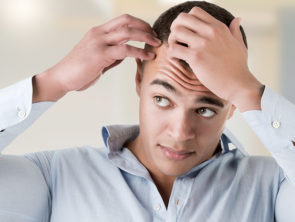 Male Pattern Baldness